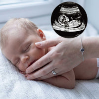 Thumbnail for Photo Projection Bracelet - From Ultrasound to Forever